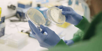 Bacteria growing on an agar plate.