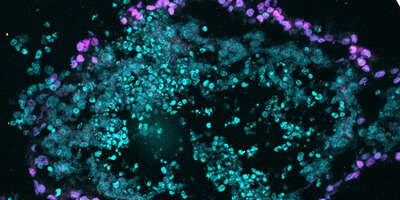 Differentiating mouse embryonic stem cells.