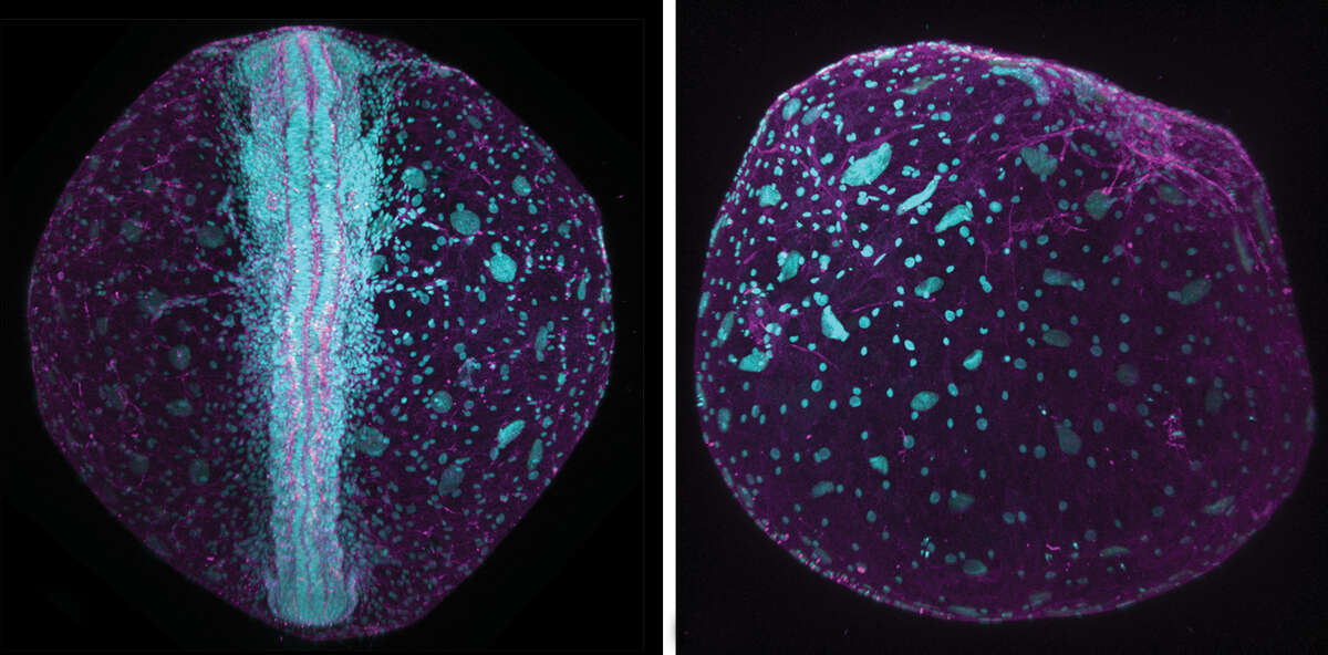 Annual Killifish embryo. Left: embryo with a developed axis; Right: embryo without formation of axis.