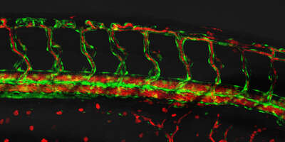 Blood vessels (green) of a zebrafish, filled with blood cells (red).