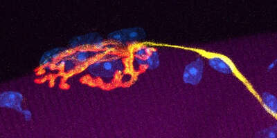 The nerve (yellow) communicates with skeletal muscle fibers (purple) at neuromuscular junctions (red).