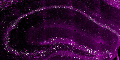 Early-born neurons in the hippocampus of the mouse brain.